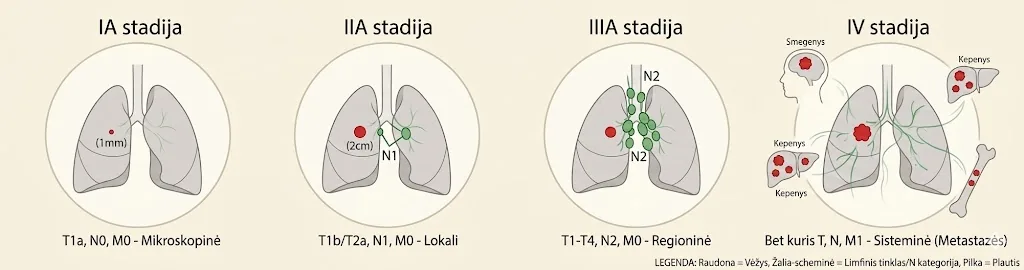 Lung cancer stages diagram
